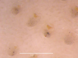 To NMNH Extant Collection (iz bry 21071 Cellarinella terminata colony autozooids 25x)