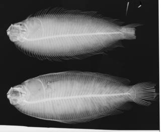 To NMNH Extant Collection (Limanda beani USNM 26102 lectotype radiograph)