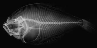 To NMNH Extant Collection (Citharichthys platophrys USNM 43415 holotype radiograph)