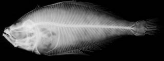 To NMNH Extant Collection (Citharichthys fragilis USNM 44409 lectotype radiograph)