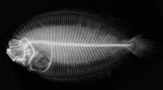 To NMNH Extant Collection (Poecilopsetta hawaiiensis USNM 51638 holotype radiograph)