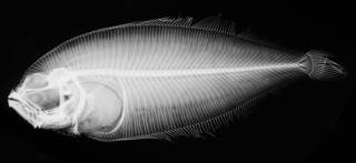 To NMNH Extant Collection (Anticitharus debilis USNM 51657 radiograph)