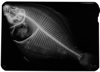 To NMNH Extant Collection (Lepidopsetta mochigarei USNM 68245 holotype radiograph)