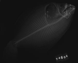 To NMNH Extant Collection (Pleuronichthys nephelus USNM 74606 holotype radiograph)