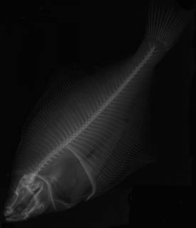 To NMNH Extant Collection (Limanda korigarei USNM 75669 holotype radiograph)