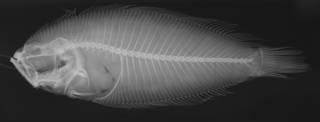To NMNH Extant Collection (Citharoides macrolepidotus USNM 75670 holotype radiograph)
