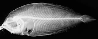 To NMNH Extant Collection (Arnoglossus japonicus USNM 75671 radiograph)