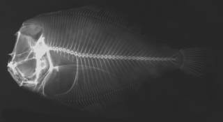 To NMNH Extant Collection (Citharichthys amblybregmatus USNM 203589 holotype radiograph)
