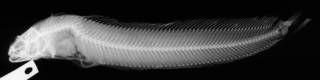 To NMNH Extant Collection (Bryostemma tarsodes USNM 50570 holotype radiograph lateral view)