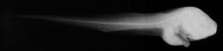 To NMNH Extant Collection (Paraliparis melanobranchus USNM 73346 holotype radiograph lateral view)