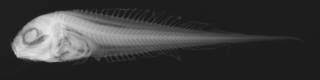 To NMNH Extant Collection (Paraliparis entochloris USNM 73347 holotype radiograph lateral view)