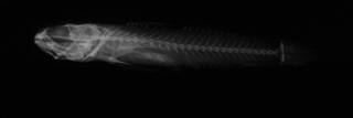To NMNH Extant Collection (Chriolepis benthonis USNM 47641 holotype radiograph lateral view)