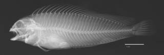 To NMNH Extant Collection (Chasmodes saburrae USNM 030824 holotype radiograph lateral view)