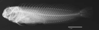To NMNH Extant Collection (Hypsoblennius lignus USNM 081937 type radiograph lateral view)