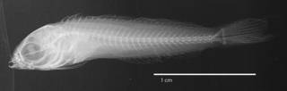 To NMNH Extant Collection (Ophioblennius capillus USNM 120032 type radiograph lateral view)