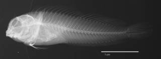 To NMNH Extant Collection (Hypleurochilus pseudoaequipinnis USNM 319832 holotype radiograph lateral view)