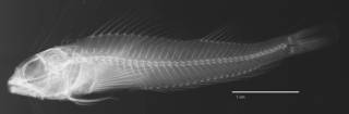 To NMNH Extant Collection (Helcogramma striata USNM 221667 holotype radiograph lateral view)