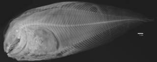 To NMNH Extant Collection (Careproctus rastrinus USNM 73331 holotype radiograph)