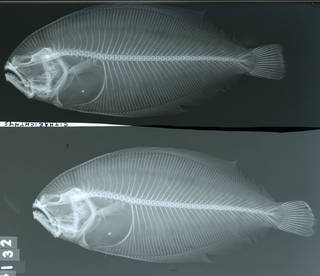 To NMNH Extant Collection (Citharichthys panamensis USNM 44132 syntype radiograph lateral view)