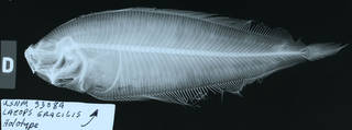 To NMNH Extant Collection (Laeops gracilis USNM 93084 holotype radiograph lateral view)