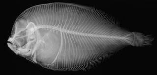 To NMNH Extant Collection (Arnoglossus maculipinnis USNM 93093 holotype radiograph lateral view)