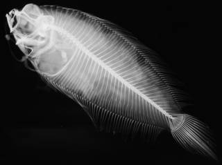 To NMNH Extant Collection (Poecilopsetta megalepis USNM 93094 holotype radiograph lateral view)