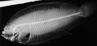To NMNH Extant Collection (Poecilopsetta albomarginata USNM 93303  holotype radiograph lateral view)