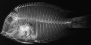 To NMNH Extant Collection (Ctenochaetus binotatus USNM 136125 ype radiograph lateral view)
