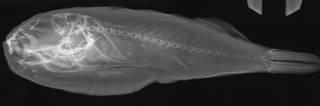 To NMNH Extant Collection (Takifugu pseudommus USNM 85892 radiograph lateral view)