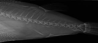 To NMNH Extant Collection (Sphoeroides parvus USNM 156492 radiograph predorsal and caudal area close up, smaller specimen)
