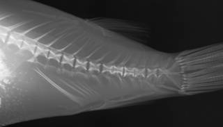To NMNH Extant Collection (Chelonodon patoca USNM 168506 radiograph predorsal caudal 1)
