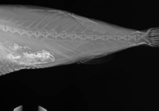 To NMNH Extant Collection (Lagocephalus laevigatus USNM 393444 radiograph predorsal and caudal area, specimen 1)