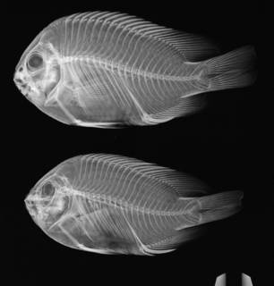 To NMNH Extant Collection (Stegastes rectifraenum USNM 50449 radiograph)