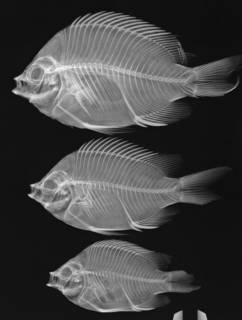 To NMNH Extant Collection (Abudefduf troscheli USNM 181297 radiograph 3 of 7)
