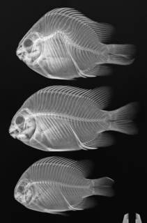 To NMNH Extant Collection (Abudefduf declivifrons USNM 181315 radiograph 3 of 5)