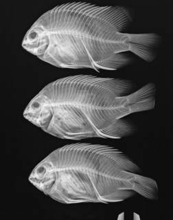 To NMNH Extant Collection (Stegastes redemptus USNM 339330 radiograph 3 of 6)