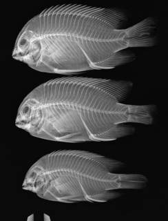 To NMNH Extant Collection (Stegastes arcifrons USNM 363567 radiograph 3 of 30)