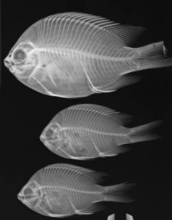 To NMNH Extant Collection (Abudefduf troscheli USNM 364531 radiograph 3 of 6)