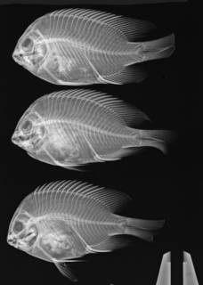 To NMNH Extant Collection (Stegastes flavilauts USNM 367519 radiograph 3 of 5)