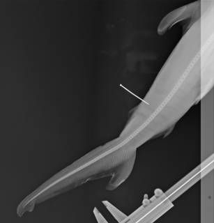 To NMNH Extant Collection (Cestracion oceanica USNM 153587 syntype radiograph caudal area)