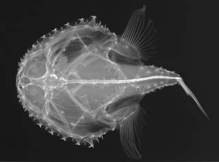 To NMNH Extant Collection (Halieutichthys reticulatus USNM 134197 radiograph)