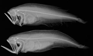 To NMNH Extant Collection (Chascanopsetta USNM 159252 radiograph)