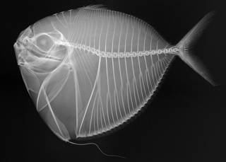 To NMNH Extant Collection (Mene maculata USNM 307872 radiograph)