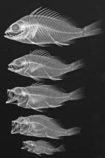 To NMNH Extant Collection (Lepidoperca coatsii USNM 394682 radiograph lateral 5 specimens)