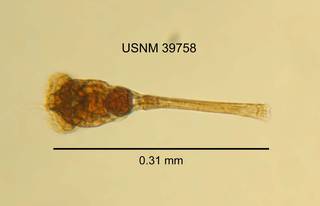 To NMNH Extant Collection (IZ WRM 39758 Conochilus unicornis length 31 photo)