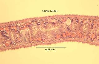 To NMNH Extant Collection (IZ WRM 52763 Procotyla typhlops diameter 23 at 10x photo)