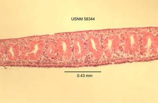 To NMNH Extant Collection (IZ WRM 58344 Planaria dactyligera diameter 17 at 4x photo)