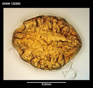To NMNH Extant Collection (Litoscalpellum simplex, photo 2)