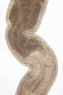 Ototyphlonemertes duplex image
