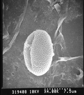 Microdesmis yafungana image